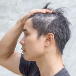 Ubanan Karena Stres Ternyata Bisa Hitam Lagi, Kok Bisa?
