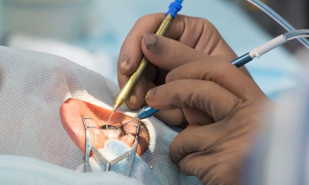 Biar Gak Nyesel: Cek Kekurangan Lasik Mata Ini